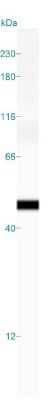 Simple Western: Actin (Muscle Specific) Antibody (HHF35) [NBP2-34230]