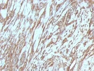 Immunohistochemistry-Paraffin: Actin (Muscle Specific) Antibody (MSA/953) - IHC-Prediluted [NBP2-48189]
