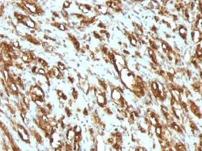 Immunohistochemistry-Paraffin: Actin (Muscle Specific) Antibody (MSA/953) - IHC-Prediluted [NBP2-48189]