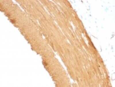 Immunohistochemistry-Paraffin: Actin (Muscle Specific) Antibody (MSA/953) - IHC-Prediluted [NBP2-48189]