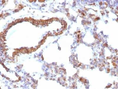 Immunohistochemistry-Paraffin: Actin (Muscle Specific) Antibody (MSA/953) [NBP2-45274]