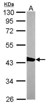 Western Blot: CapG Antibody [NBP2-15259]