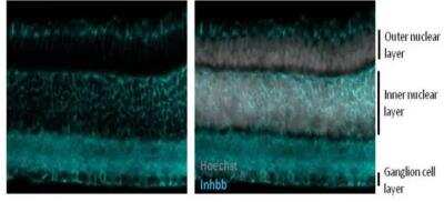 Immunohistochemistry-Frozen: Activin B/Inhibin beta B Antibody [NBP2-16966]