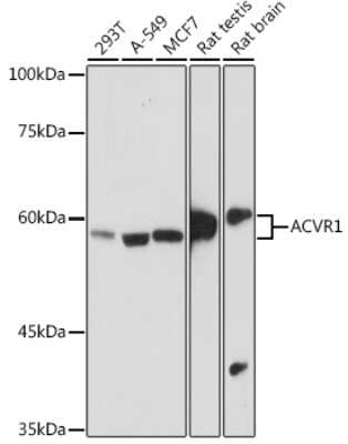 Western Blot: Activin RIA/ALK-2/Activin Receptor Type 1 Antibody (1J7G4) [NBP3-15732]
