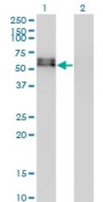 Western Blot: Activin RIA/ALK-2/Activin Receptor Type 1 Antibody (2D5) [H00000090-M07]