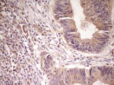 Immunohistochemistry: Activin RIIA Antibody (OTI5D1) - Azide and BSA Free [NBP2-70079]