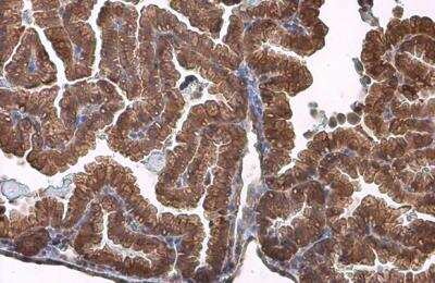 Immunohistochemistry-Paraffin: Activin RIIB Antibody [NBP2-15268]