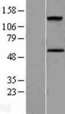 Western Blot: ALK-7/Activin Receptor Type 1C Overexpression Lysate [NBL1-07296]