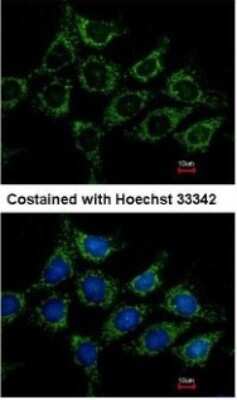Immunocytochemistry/ Immunofluorescence: Acylglycerol Kinase Antibody [NBP1-32163]