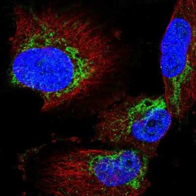 Immunocytochemistry/ Immunofluorescence: Acylglycerol Kinase Antibody [NBP2-49085]