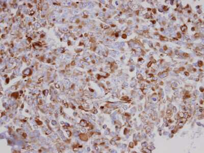 Immunohistochemistry-Paraffin: Acylglycerol Kinase Antibody [NBP1-32163]