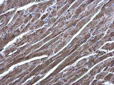 Immunohistochemistry-Paraffin: Acylglycerol Kinase Antibody [NBP1-32163]