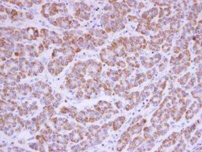 Immunohistochemistry-Paraffin: Acylglycerol Kinase Antibody [NBP1-32163]