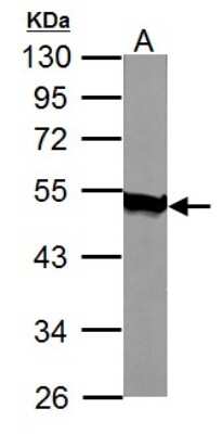 Western Blot: Acylglycerol Kinase Antibody [NBP1-32163]