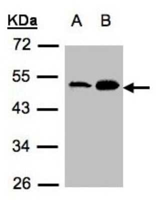 Western Blot: Acylglycerol Kinase Antibody [NBP1-32163]