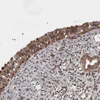 Immunohistochemistry: Acyloxyacyl Hydrolase Antibody [NBP2-33905]