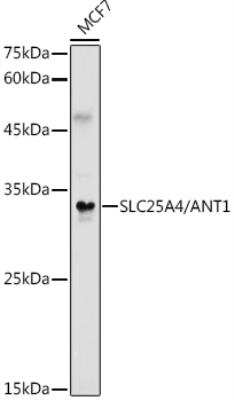 Western Blot: Adenine Nucleotide Translocase 1 AntibodyAzide and BSA Free [NBP2-92642]