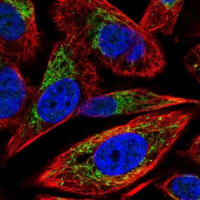 Immunocytochemistry/ Immunofluorescence: Adenine Nucleotide Translocator 2 Antibody [NBP2-56762]