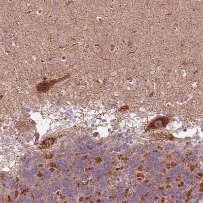 Immunohistochemistry-Paraffin: Adenine Nucleotide Translocator 2 Antibody [NBP2-57642]