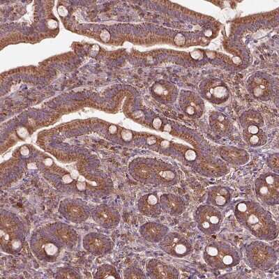 Immunohistochemistry-Paraffin: Adenine Nucleotide Translocator 2 Antibody [NBP2-57642]