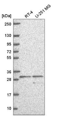 Western Blot: Adenine Nucleotide Translocator 2 Antibody [NBP2-57642]