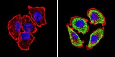 Immunocytochemistry/ Immunofluorescence: Adenosine A2aR Antibody [NB300-597]