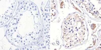 Immunohistochemistry-Paraffin: Adenosine A2aR Antibody [NB300-597]