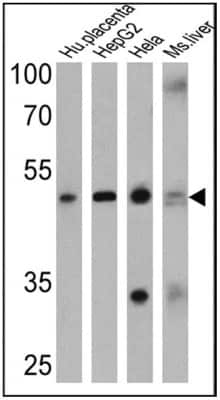 Western Blot: Adenosine A2aR Antibody [NB300-597]