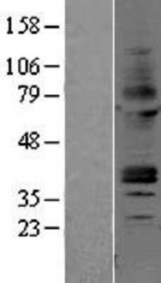 Western Blot: Adenosine A2aR Overexpression Lysate [NBP2-04171]