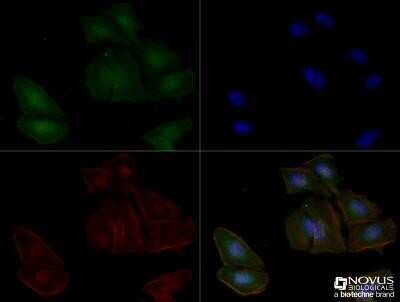 Immunocytochemistry/ Immunofluorescence: Adenosine A2aR Antibody (7F6-G5-A2) - Azide and BSA Free [NBP2-80562]
