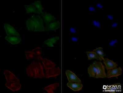 Immunocytochemistry/ Immunofluorescence: Adenosine A2aR Antibody (7F6-G5-A2) - BSA Free [NBP1-39474]