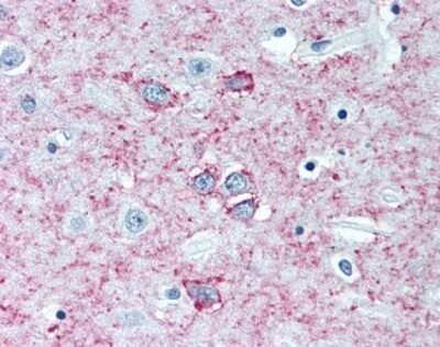 Immunohistochemistry-Paraffin: Adenosine A2aR Antibody (7F6-G5-A2) - BSA Free [NBP1-39474]
