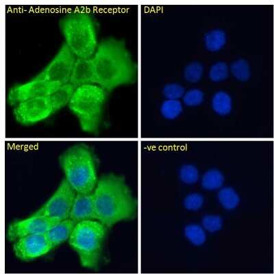 Immunocytochemistry/ Immunofluorescence: Adenosine A2b R Antibody [NB600-797]