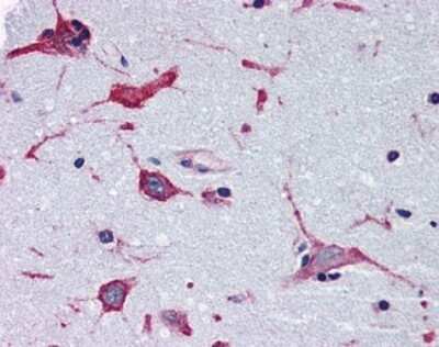 Immunohistochemistry-Paraffin: Adenosine A2b R Antibody - BSA Free [NBP1-44332]