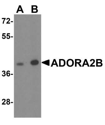 Western Blot: Adenosine A2b R AntibodyBSA Free [NBP2-41312]