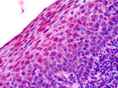 Immunohistochemistry-Paraffin: Adenosine A3 R Antibody [NLS689]