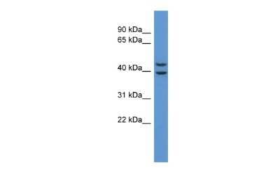 Western Blot: Adenosine A3 R Antibody [NBP2-88764]