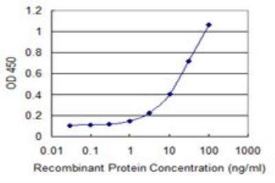 ELISA: Adenosine Deaminase 2/CECR1 Antibody (3D11) [H00051816-M01]