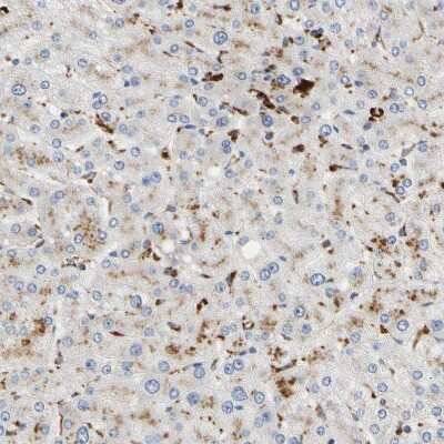Immunohistochemistry-Paraffin: Adenosine Deaminase 2/CECR1 Antibody [NBP1-89238]