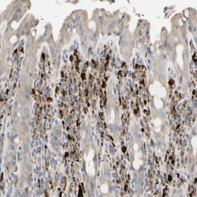 Immunohistochemistry-Paraffin: Adenosine Deaminase 2/CECR1 Antibody [NBP1-89238]