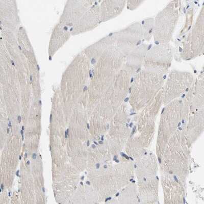 Immunohistochemistry-Paraffin: Adenosine Deaminase 2/CECR1 Antibody [NBP1-89238]