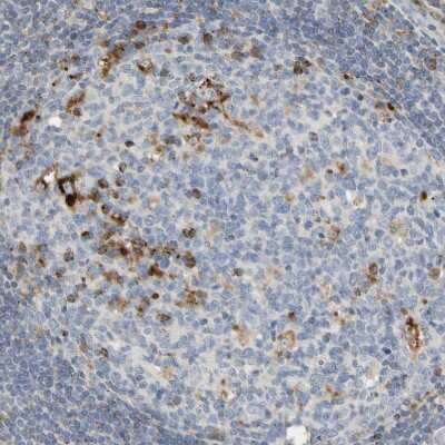 Immunohistochemistry-Paraffin: Adenosine Deaminase 2/CECR1 Antibody [NBP1-89238]