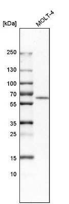 Western Blot: Adenosine Deaminase 2/CECR1 Antibody [NBP1-89238]