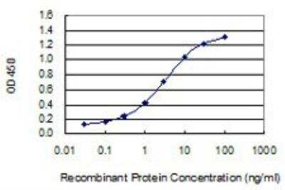 ELISA: Adenosine Deaminase/ADA Antibody (4G4-1C6) [H00000100-M01]