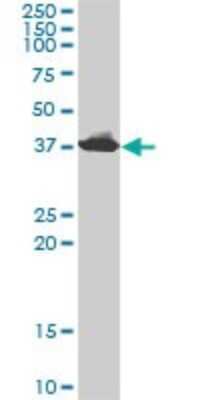 Western Blot: Adenosine Deaminase/ADA Antibody (4G4-1C6) [H00000100-M01]