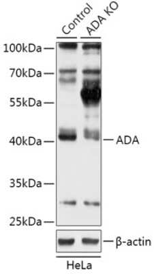 Knockout Validated: Adenosine Deaminase/ADA Antibody - Azide and BSA Free [NBP3-03469]