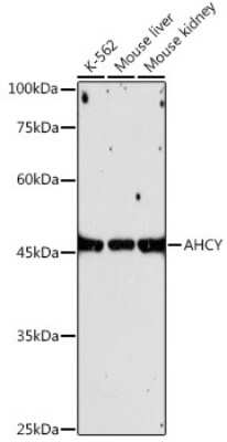 Western Blot: Adenosylhomocysteinase/AHCY Antibody (4E9H10) [NBP3-16147]