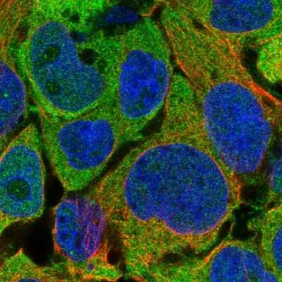 Immunocytochemistry/ Immunofluorescence: Adenosylhomocysteinase/AHCY Antibody [NBP2-48817]
