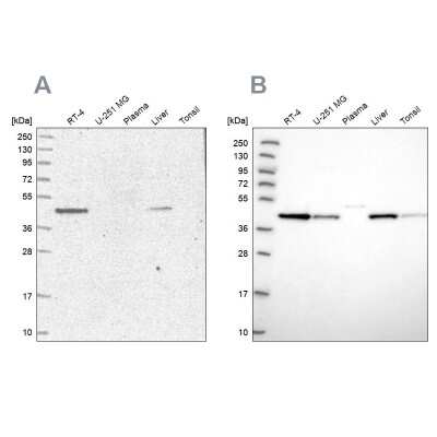 Western Blot: Adenosylhomocysteinase/AHCY Antibody [NBP2-48731]