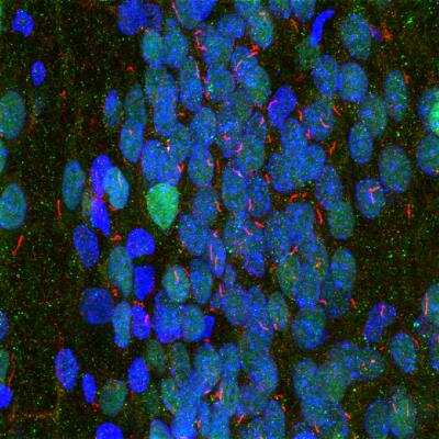 Immunocytochemistry/ Immunofluorescence: Adenylate Cyclase 3 Antibody [NBP1-92683]